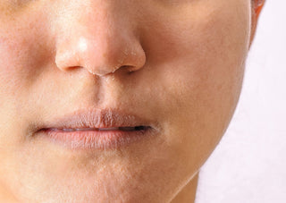 The difference between dry and dehydrated skin and how to fix both